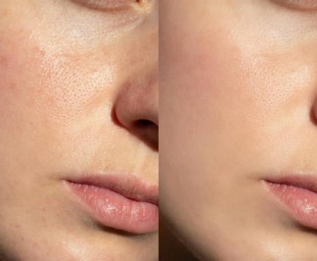 traitements anti-âge traitements anti-âge