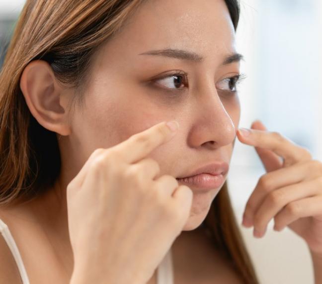 soins pour cernes pigmentaires à Lille soins pour cernes pigmentaires à Lille